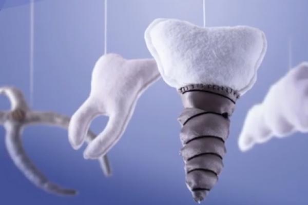 Stomatološke sanacije u potpunoj anesteziji!